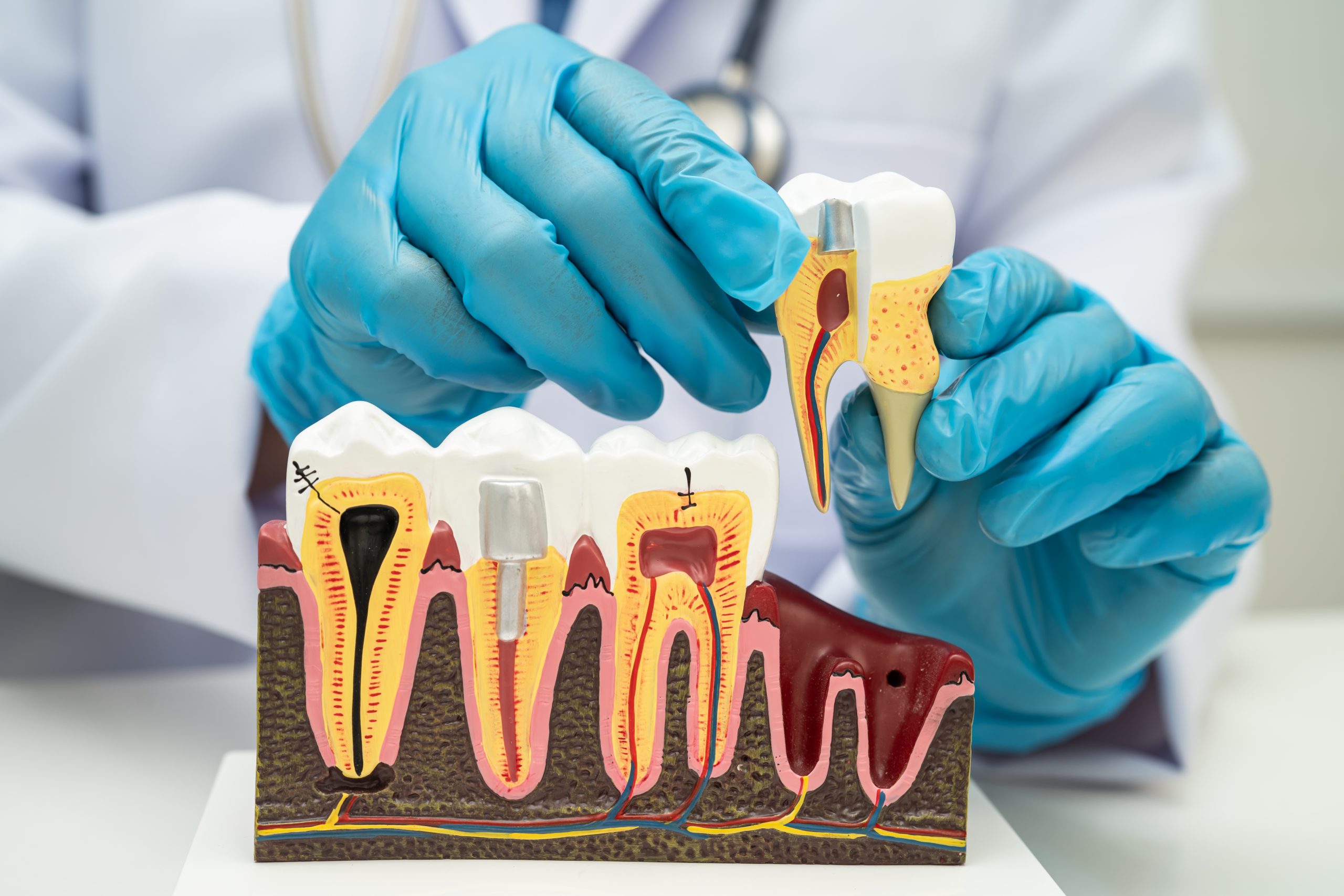 Enfermedades periodontales