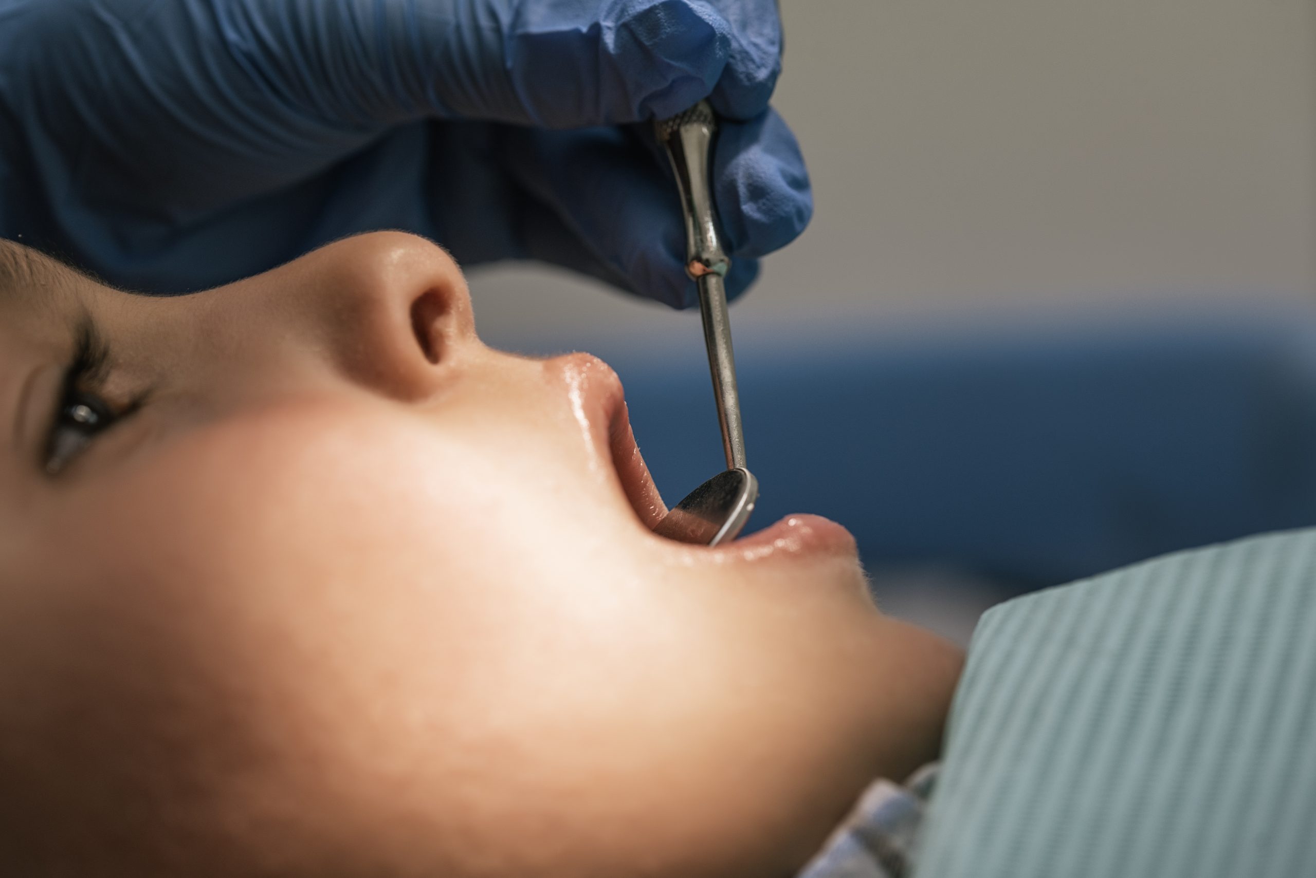 Elevación de Seno Maxilar